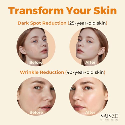 Vitamin C Serum for Face, Facial Serum for Dark Spot, Anti Aging with Vitamin C, Hyaluronic Acid, Christmas Stocking Stuffers, Skin Care Gifts for Women, 60ml