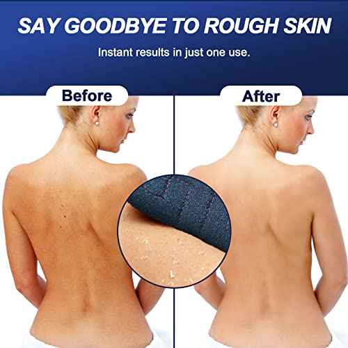 Exfoliating Back Scrubber for Shower, 38 Inches Long Back Exfoliator with Two Handles for Men and Women Acne, Double-Sided Bath Back Washer Body Cleaner to Scrub Your Skin