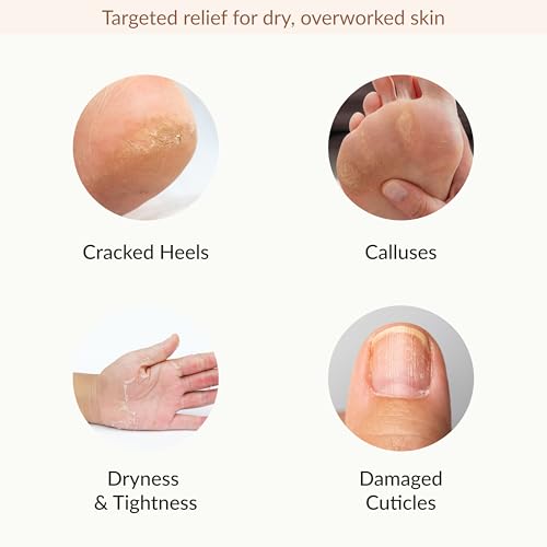Epielle Hydrating & Moisturizing Hand & Foot Masks for Dry, Rough Skin, Self Care Gifts for Women, Spa Kit, Stocking Stuffers, Thanksgiving Essentials, 6 Moisturizing Gloves & 6 Moisturizing Socks
