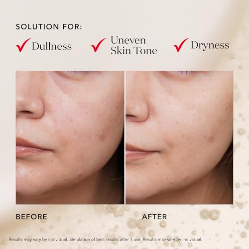 SK-II Facial Masks - Brightening Face Mask Sheets to Help Improve Tone, Texture & Radiance - Anti-Aging Treatment for Replenished Moisture & Visibly Healthier Skin