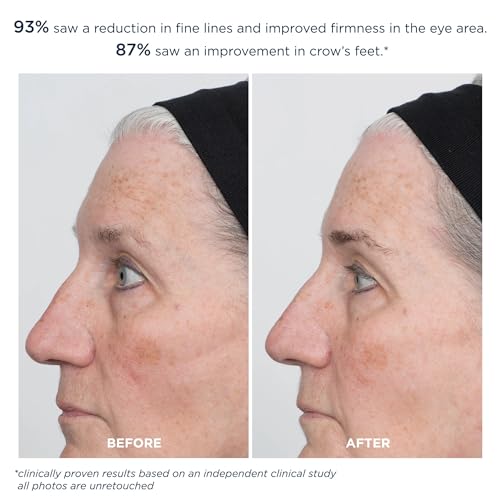 m-61 ProSmooth Retinol Eye Serum | 0.1% Non-Irritating Retinol Eye Serum with Vitamin C, 0.5 Fl Oz