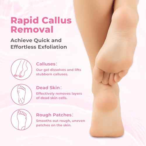 Foot Callus Remover with Foot File, Extra Strength Callus Remover Gel with Brush Head, Professional Dead Skin Removal for Feet, 8oz
