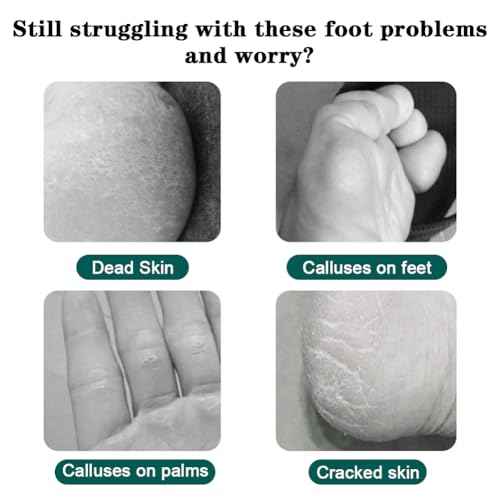 Professional Pedicure Foot Spa Set,10 in 1 Pedicure Set for Feet, Stainless Steel Foot Care Kit, Rasp Dead Skin Remover