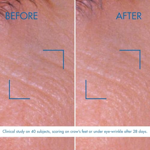 Biotherm Blue Pro-Retinol Wrinkle Smoothing Eye Cream, Anti-Wrinkle and Dark Circles Eye Care with Biotech Plankton & Pro-Retinol, Smoothes and Brightens, Ophthalmologically Tested, Vegan, 0.5 Fl. Oz