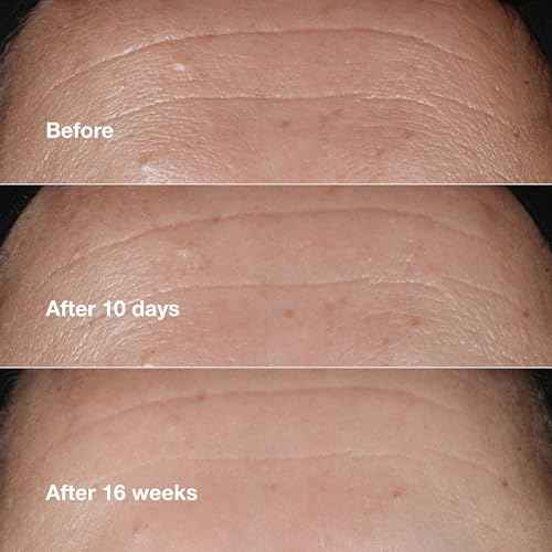 Clinique Smart Skin School Supplies: Smooth + Renew Lab Gift Set | Smart Clinical Repair Wrinkle Correcting Cream, Face Serum + Eye Cream | Anti-Aging + Hydrating | Includes 3 Travel Size Pieces