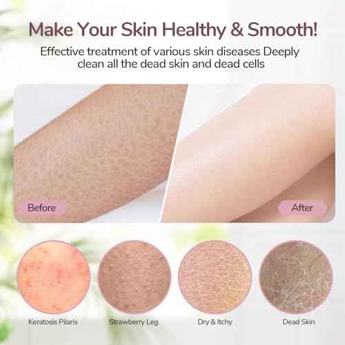 Deep Exfoliating Gloves for Body, Exfoliating Mitt for Shower Ideal for Dead Skin Remover, Dual Texture (Coarse & Fine), Thicken, Non-Slip Inside, Random color (1 Pack)