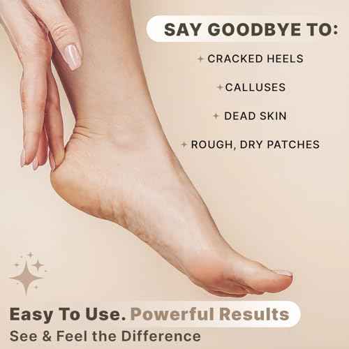 Pumice Stone for Feet - Natural Lava Stone Foot Exfoliator, Callus Remove for Feet, Hands & Dead Skin, Foot Scrubber for Pedicure & Cracked Heels, Strong & Durable Design for Smooth & Soft Feets