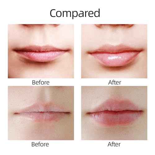 Lip Plumping Enhance - Soft Silicone Lips Enhancer Plumper Tool Device - Enlarge Mouth Lips Enlargement Tools Plumping Bigger Lips Device Christmas Gift
