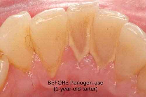 Periogen Complete Oral Health Rinse (3-PK)