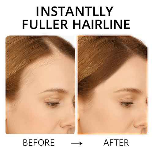 Hairline Powder with Brush ? Root Touch Up & Hair Shading Powder, Long-Lasting Matte, Sweat & Humidity Resistant, Covers Thinning Edges/Wide Part/Gray Roots ? Travel-Friendly Compact [Dark Brown]