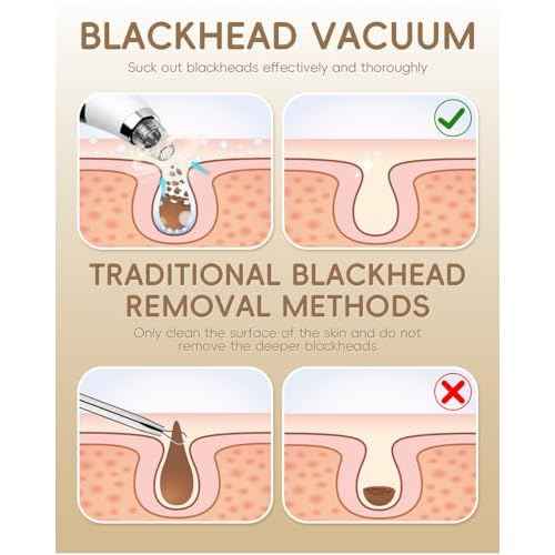Facial Pore Blackhead Remover Vacuum - Fore Cleaner and Blackhead Extractor with 3 Adjustable Suction Levels - 5 Probes - Pore Vacuum Kit for Women&Men (White)