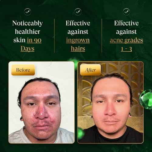 douxds Flex¢â Pro Vibrating Face Brush, Electric Face Scrubber, Face Scrubber for Men, Flex¢â Face Brush, Men's Skin Care, Powerful Sonic Technology, Removes Dark Marks and Bumps, Acne Treatment