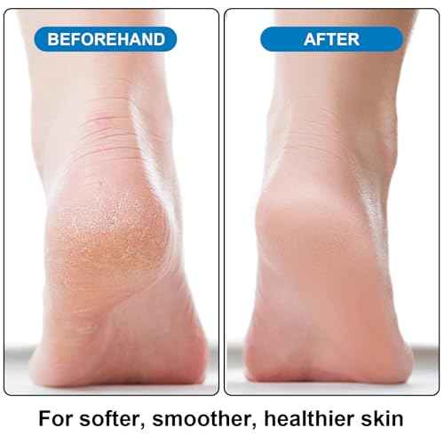 Foot Pumice Stone 4 Pack Pedicure Stone for Feet Pumice Sponge for Feet Callus Remover and Scrubber Double Sided Pedicure Foot Pumice Stone for Feet and Heels Callus and Dead Skins (Purple)