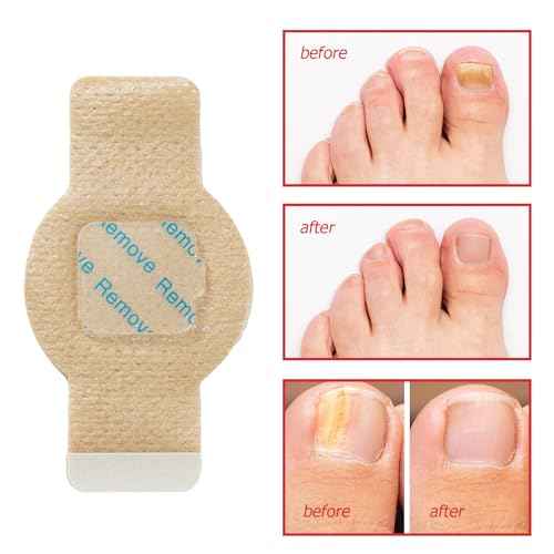 Fungal Nail Patches 21 PCS -Toenail Treatment Extra Strength - Nail Repair for Restores Damaged Nails and Appearance of Discolored