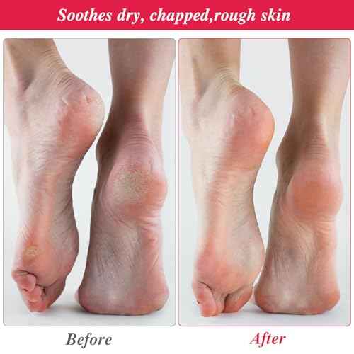 10-Pack White Spa Cotton Socks, Reusable Hydrating Socks, Cotton Blend Breathable Foot Mask Sleeves for Dry, Cracked Feet Relief, Overnight Moisturizing Foot Care, Home SPA Therapy