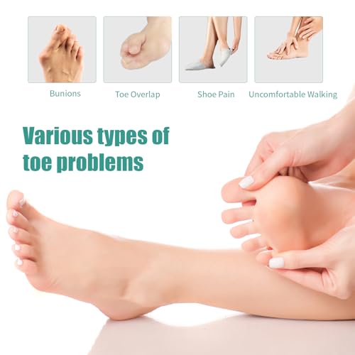 4 Pcs Silicone Toe Spacers ? Yoga Toe Separators for Toe Straightening & Relaxation | Correct Overlapping Toes, Bunions, Hammer Toe | Toe Support toe separators for Women & Men (Tan, 3.98)