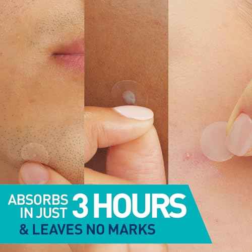 CeraVe Hydrocolloid Blemish Patches, Oil Absorbing Spot Control with Ceramides and Niacinamide, Allergy-Tested & Suitable For Sensitive Skin, Ultra-Thin & Blends Into All Skin Tones, 22ct