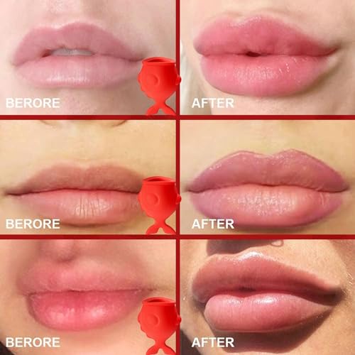 Generic Fish Lip Plumper - Fish-Shaped Lip Plumping Device, Silicone Lip Sucker Plumper Tool | Long-Lasting Lip Pump Plumer for Lip Care | Sexy Lip Mouth Enhancement Device for Lip Suction Plumper