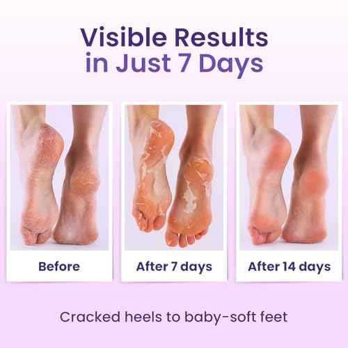 Foot Peeling Mask (6 pairs) Exfoliating Foot Mask for Dry Cracked Feet with Lavender & Shea Butter, Dead Skin & Callus Remover for Feet, Exfoliating Socks for Women & Men, One Size Fits Most