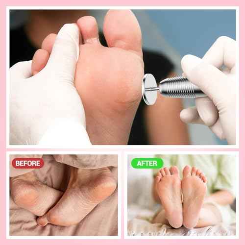 MelodySusie 60 Pcs Replacement Sandpaper Discs with 25mm Metal Nail Drill Bit, 80 Coarse 120 Medium 180 Fine Grit for Electric Foot File Callus Remover Tool or Polishing Craft