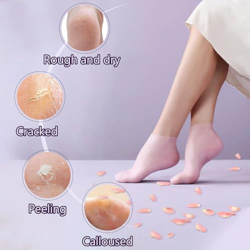 2 Pairs Silicone Socks for Dry Cracked Feet, Women's Foot Socks for Moisturizing (Pink & Beige, Fits Up to Size 9)