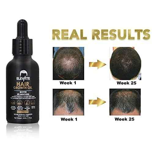 Elevate Hair Regrowth Treatment 5% Minoxidil Solution - Biotin Serum Hair Growth Oil for Men & Women - Thicker Fuller Stronger Hair - Stops Hair Loss & Thinning - Natural Hair Thickening Treatment 1oz