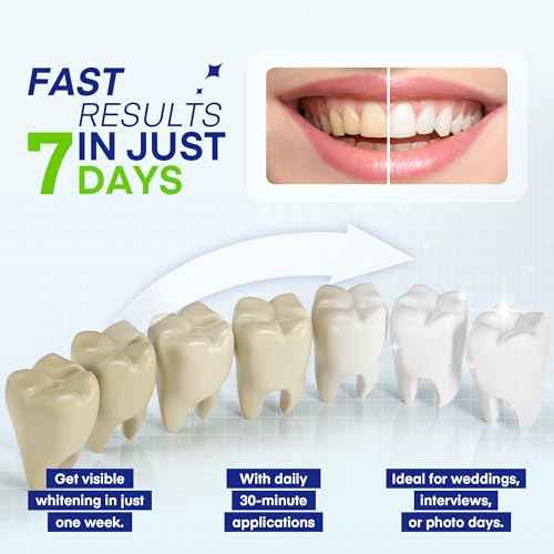 Teeth Whitening Pen ? 35% Urea Peroxide Gel, Clear Twist-Dispensing Whitening Pens for Stain Removal, Professional-Strength, Easy-to-Use, Travel-Friendly(A Set of 5 Pens)