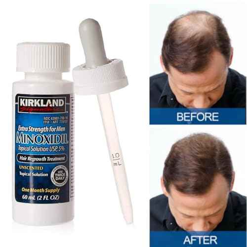 Minoxidil-5% Extra Strength Hair Regrowth for Men, 6 Month Supply