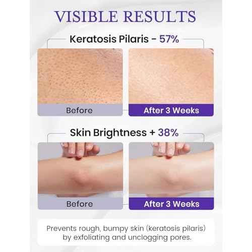 Elvira KP Bump Eraser Foot & Body Scrub, Exfoliating Scrub for Keratosis Pilaris, Smooth Skin with 10% AHA BHA & Niacinamide, Deep Moisturizing Cleanser for All Skin Types, Exfoliante para el Cuerpo