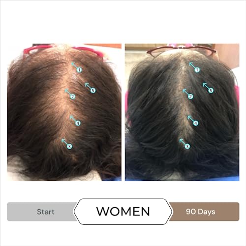 DS Labs Spectral Men's & Spectral Booster, Hair Density Serum - Leave-In, Strengthening, Thickening, Minimize Shedding, 60mL, Packaging May Vary