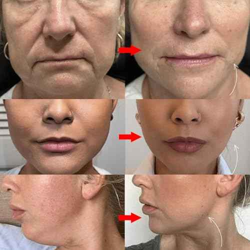Double Chin Lifting Mask, Lift Chin Mask, Reusable Silicone Double Chin Strap Sleep Masks, Say Goodbye to Your Double Chin - Get a Sculpted Jawline in 3 Weeks (2PCS)