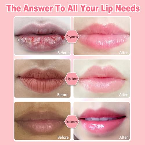 9 PCS Bee Lip Balm Honey Pot, Propolis Fruits Lip Balm Bulk, Hydrating Sleeping Lip Mask Overnight Prevention Dry & Cracked, Smooth Lips & Reduce Lip Lines