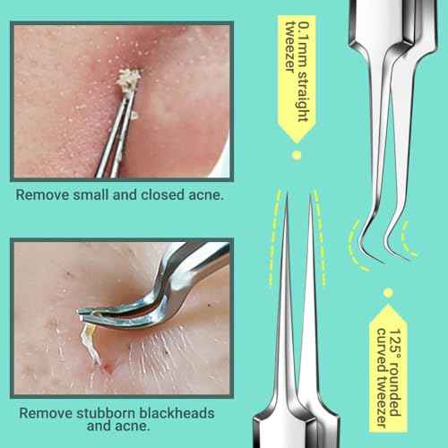 TsMADDTs Blackhead Remover Tools and Ingrown Hair Tweezers, 9PCS Pimple Popper Tool Kit, Ingrown Hair Removal Kit with Pimple Extractor, Pore Extractor, Tweezers, Razor
