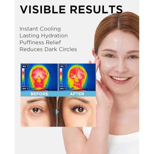 The SAEM Iceland Hydrating Eye Stick 0.24oz - Cooling Eye Balm for Dark Circles and Puffiness ? Under Eye Treatment - Reduce Wrinkles and Moisturizing - Minimize Dark & Puffy Eyes - Aqua Scent