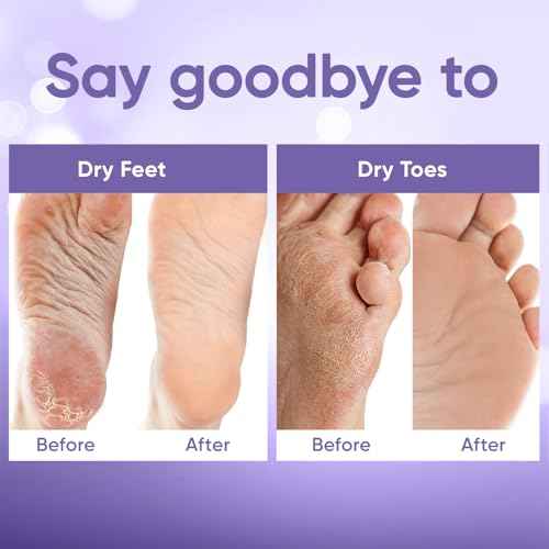 Foot Peel Mask - Foot Mask for Baby Soft Skin - Remove Dead Skin, Dry, Cracked Feet & Callus, Foot Spa, Made with Aloe Vera Extract for Women and Men (2 Pair (Pack of 1), Lavender)