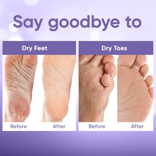 Foot Peel Mask - Foot Mask for Baby Soft Skin - Remove Dead Skin, Dry, Cracked Feet & Callus, Foot Spa, Made with Aloe Vera Extract for Women and Men (2 Pair (Pack of 1), Lavender)