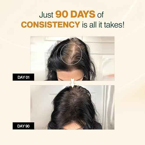 Nourish Mantra Advanced Hair Growth Serum 50ml, 3% Redensyl, 2% Anagain, 2% Procapil, 5% Rice Water, Promotes Hair Regrowth, Anti Thinning & Hair Loss Treatment,Rapid Hair Growth Serum for Women & Men
