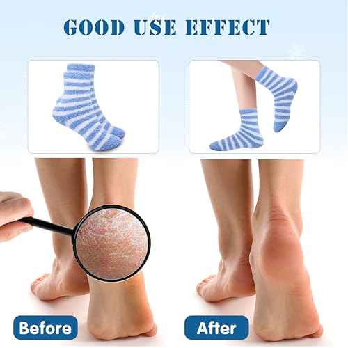 3 Pairs Aloe Socks Moisturizing Spa Socks for Dry Cracked Feet, Sleeping Fuzzy Socks Non Slip Lotion Socks for Women Men Spa, Foot Care Socks for Repairing Softening Dry Cracked Heel