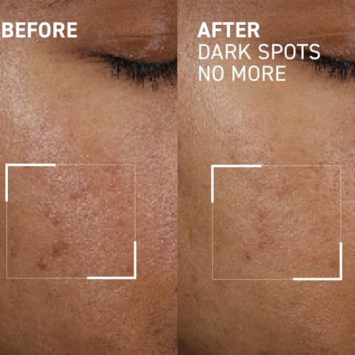 Dr. Brandt Bright This Way Dark Spots No More - Reduces Number, Intensity & Size of Pigmented Spots - 0.5 fl oz