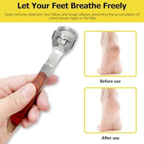 Foot Care Pedicure Callus Shaver with Wood Handle - Hard Skin Remover Including 10 Blades