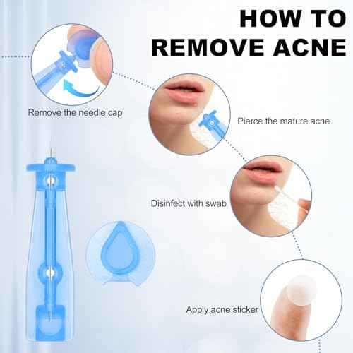 Sterile Pimple Needles, 50 Pcs Disposable Acne Needles and 72 Dots Acne Pimple Stickers - Effective Blemish & Blackhead Removal Tools for Clear Skin