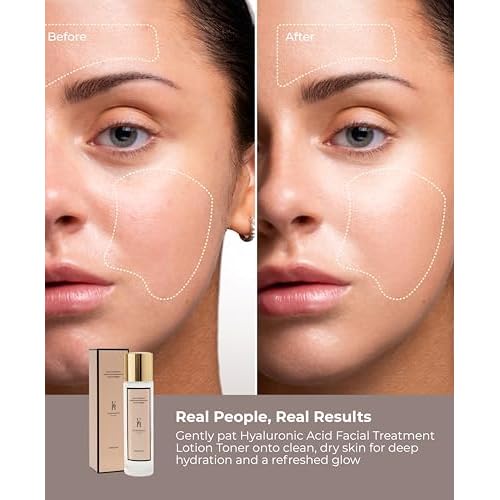 VivienneHu Facial Treatment Essence with Hyaluronic Acid & Collagen, Anti-Aging Essence Skincare to Reduce The Appearance of Fine Lines, Refines Texture, Improves Firmness & Dark Spots, 5.3Oz, 150g