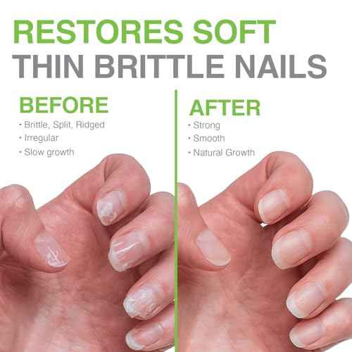 Probelle Nail Hardener Formula 1 - Repair Damaged Nails, Extra Strong Nail Growth Base Coat For Brittle Nails, Grows and Strengthens Soft, Weak Nails, Aids Splitting, Breaking, Peeling Nails