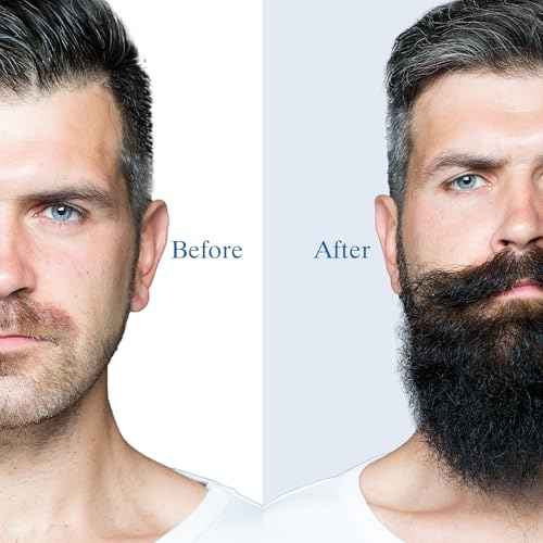 5% Minoxidil Foam for Men Hair and Beard Regrowth, Dermatologist-Recommended Lightweight Topical Solution, Thicker Fuller Hair Growth Treatment (60ml/2.11fl.oz)