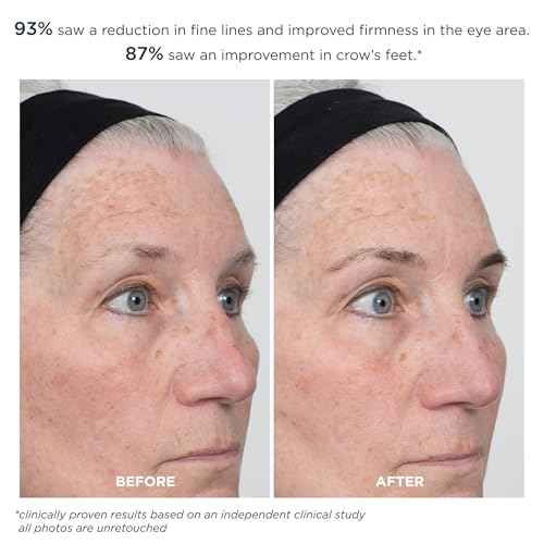 m-61 ProSmooth Retinol Eye Serum | 0.1% Non-Irritating Retinol Eye Serum with Vitamin C, 0.5 Fl Oz