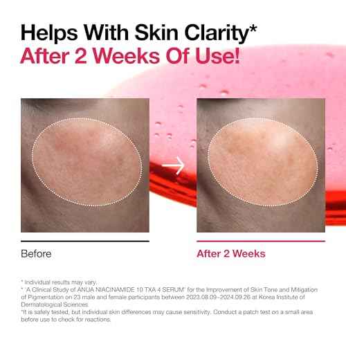 ANUA Niacinamide 10 + TXA 4 Serum, Hyaluronic Acid, Tranexamic acid, Facial Serum for Glass Skin, Clarifying, Radiant Complexion with Natural Color, Korean Skin Care (30ml /1.01 fl.oz)
