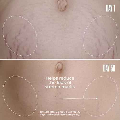 MA?LYS Cosmetics B-FLAT Belly Firming Cream - Stretch Mark, Tightening Belly Cream