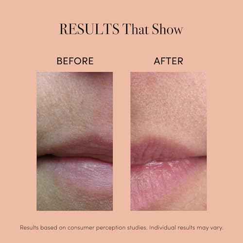 reVive Lux Collection Lip Plumper Device, LED Light Therapy Products for Lip Care, At-Home Infrared, Red & Amber Therapy for Smooth, Hydrated, Healthy-Looking Lips