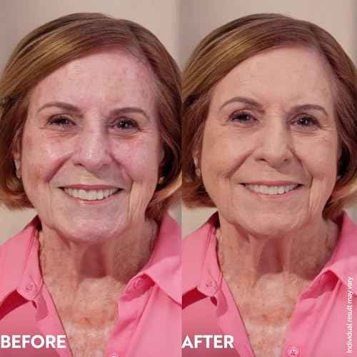 M. Asam Magic Finish Make-Up Mousse (1.01 Fl Oz) ? 4in1 Primer, Foundation, Concealer & Powder With Buildable Coverage, Hides Redness And Dark Spots, Vegan, For Light To Medium Skin Tones