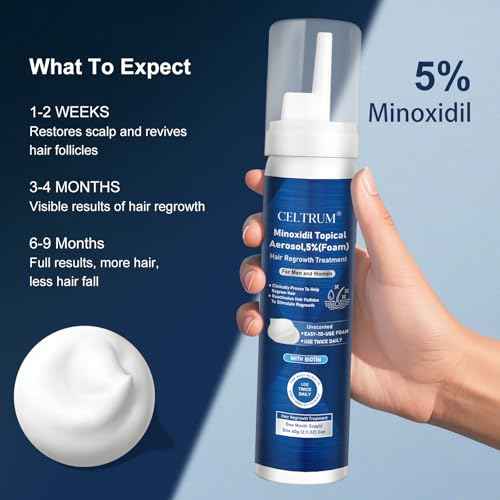 5% Topical Minoxidil Foam, Minoxidil for Men and Women, Infused with Biotin, Hair Growth Treatment, Supports Thicker and Fuller Hair & Beard (Minoxidil Foam, 8.44oz, 4 Month Supply)